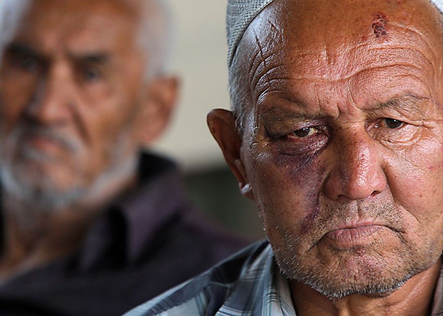Kurgunbai Inambayev, a Uzbek, is seen in the southern Kyrgyz city of Osh on Tuesday, June 15, 2010. Mr. Inambayev said the bruises on his face were inflicted by Kyrgyz attackers during days of ethnic rioting between Kyrgyz and ethnic Uzbeks. The rioting has killed at least several hundred people, or roughly double official figures, the Red Cross said Tuesday, as new reports strengthened suspicions that the rioting in Kyrgyzstan was started deliberately. (AP Photo/Sergei Grits)