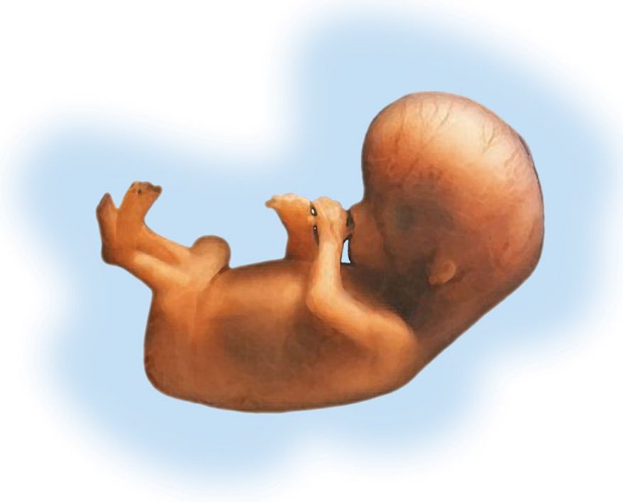 At 20 weeks