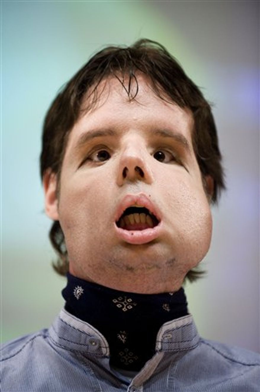 Oscar,center, a man who underwent a full-face transplant in April, poses beside Dr. Joan Barret, fourth from left, and surrounded by doctors as he appears in public for the first time in a news conference at the Vall d'Hebron Hospital in Barcelona, Spain, Monday, July 26, 2010. A 30-member medical team led by the Spanish doctor Juan Barret carried out a full-face transplant, giving a young man who lost his in an accident a new nose, skin, jaws, cheekbones, teeth and other features. (AP Photo/David Ramos)