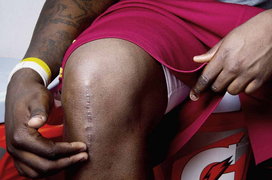 The physical - and emotional - scars ran deep for Redskins rookie defensive end Jarvis Jenkins, who has benefited from his parents' guidance. (Andrew Harnik/The Washington Times)