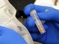 aptopix-meningitis-ou_live_2_mugshot_four_by_three.jpg