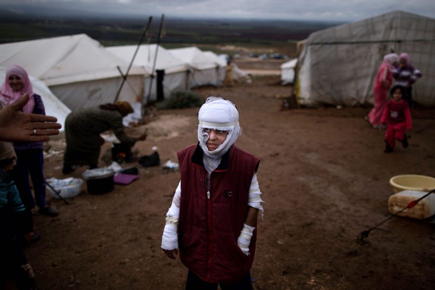 Abdullah Ahmed, 10, who suffered burns in a Syrian government airstrike and fled his home with his family, stands outside their tent at a camp for displaced Syrians in the village of Atmeh, Syria, on Dec. 11, 2012. This tent camp sheltering some of the hundreds of thousands of Syrians uprooted by the country's brutal civil war has lost the race against winter: the ground under white tents is soaked in mud, rain water seeps into thin mattresses and volunteer doctors routinely run out of medicine for coughing, runny-nosed children. (Associated Press)