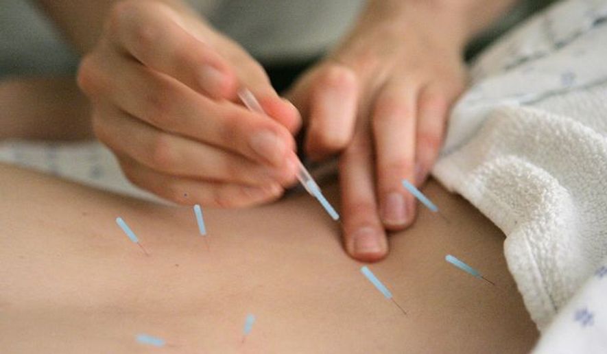 Anah McMahon, L. Ac. adjusts one inch seirin acupuncture needles in the muscles around the spine of a patient to relieve lower back pain, at the Pacific College of Oriental Medicine in Chicago on Sept. 24, 2007. (Associated Press) **FILE**