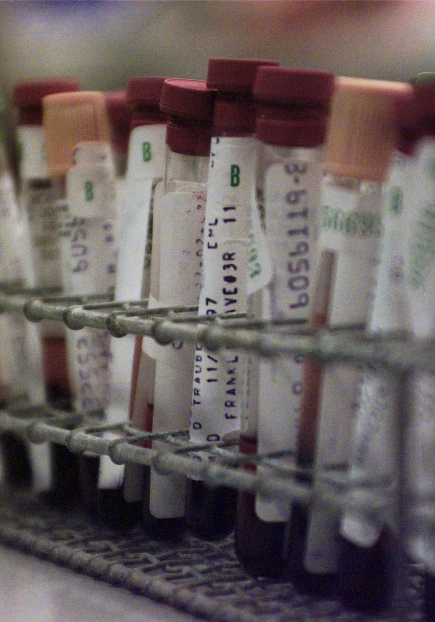 Vials of blood await testing for HIV, the virus that causes AIDS. (AP Photo/Adam Nadel)