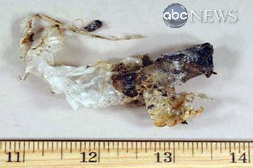 This syringe detonator was used in a failed plot to blow up an airliner over Detroit on Christmas Day. Umar Farouk Abdulmutallab reportedly told his FBI interrogators that "this is just the beginning." (ABC News)