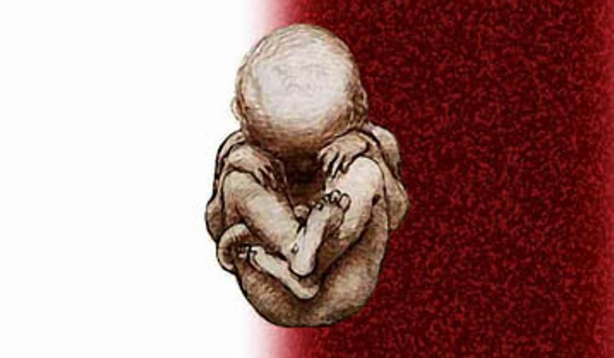 Illustration: Abortion (after Da Vinci)