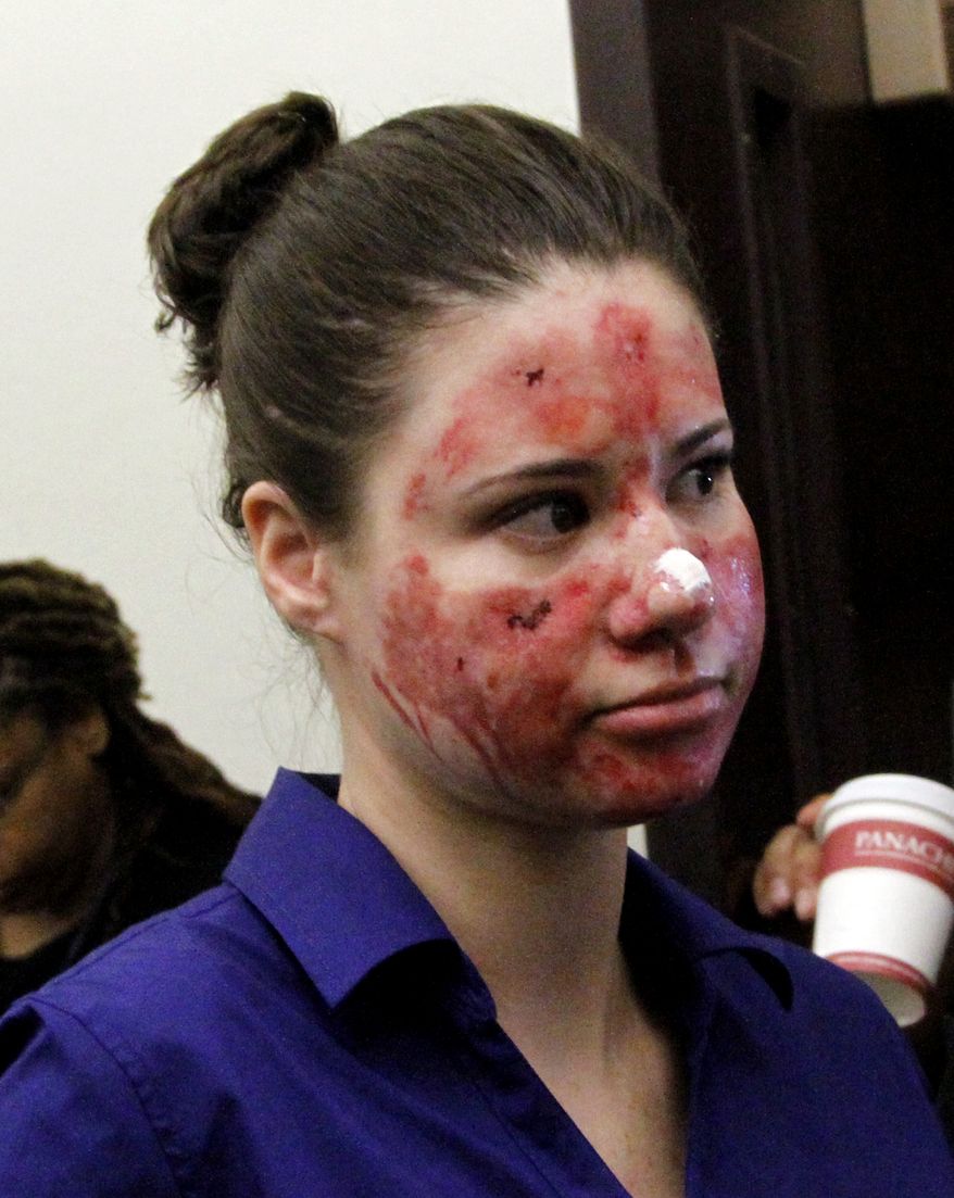 Bethany Storro, who falsely claimed that a stranger threw acid in her face, walks out of court in Vancouver, Wash., on Wednesday, Sept. 29, 2010, after pleading not guilty to three theft charges. (AP Photo/Don Ryan)