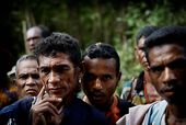 leprosy_7391