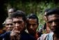 leprosy_7391