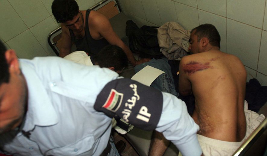 ** FILE ** In this Nov. 14, 2005, photo, Iraqi policemen show their bruises, allegedly caused by torture, as they are treated at Yarmouk hospital in Baghdad. The WikiLeaks website released nearly 400,000 documents on Friday, Oct. 22, 2010, that claim Iraqi forces mistreated, tortured and killed their captives as they battled a ruthless insurgency. (AP Photo/Khalid Mohammed)