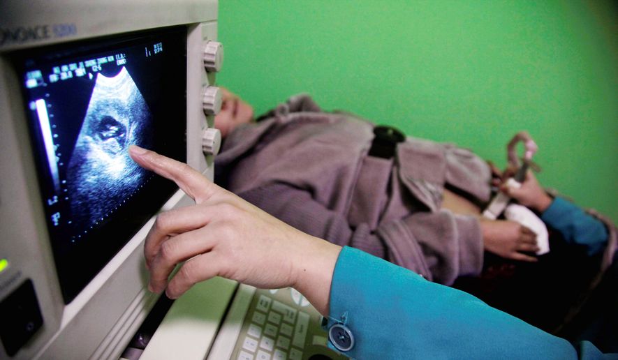 A nurse points out the image of a three-month-old fetus during a sonogram scan for a patient. (Associated Press). **FILE**