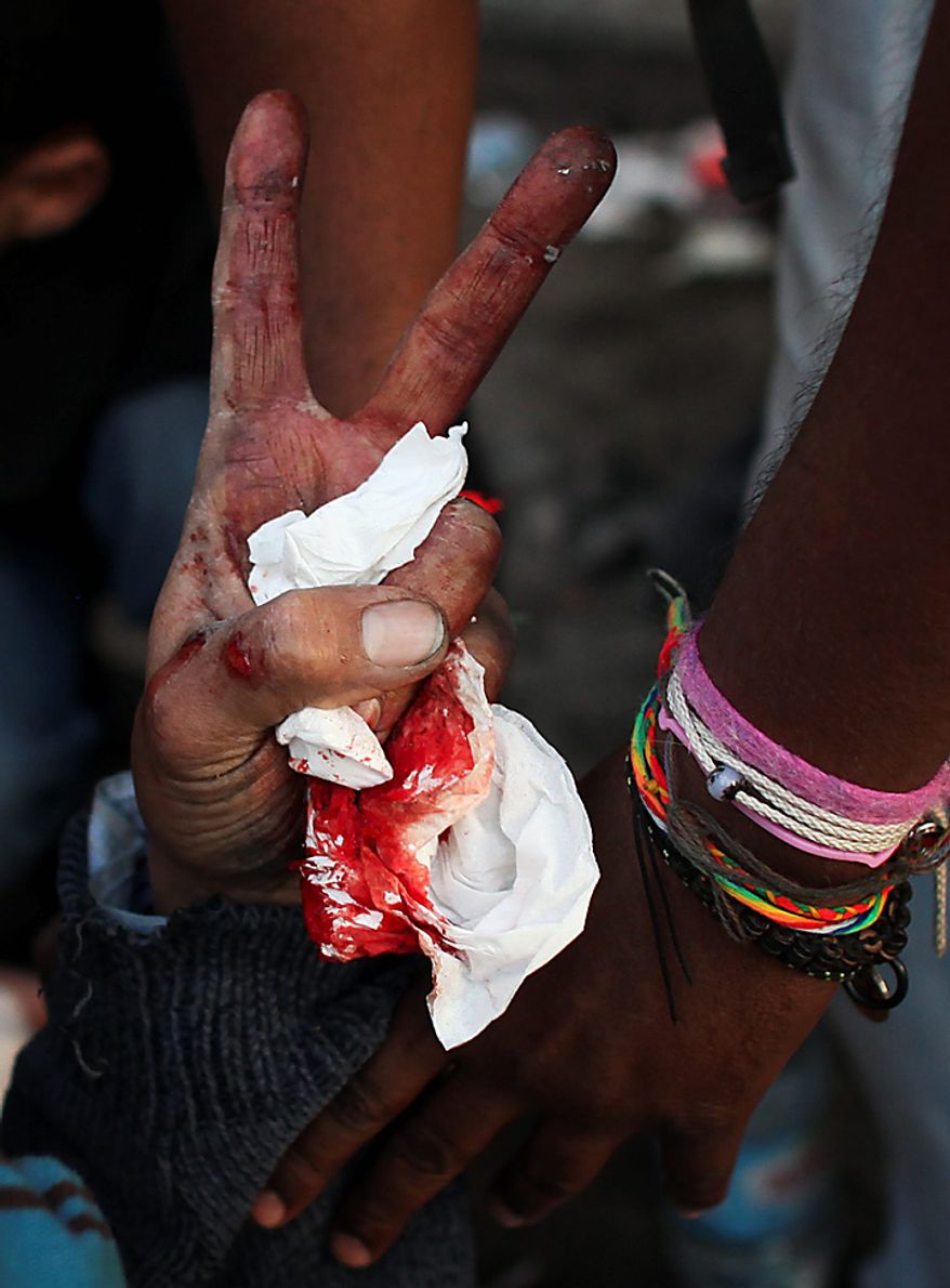An injured anti-government protester gestures as he is treated by medics during clashes in Tahrir, or Liberation Square, in Cairo, Egypt, Wednesday, Feb. 2, 2011. Several thousand supporters of President Hosni Mubarak, including some riding horses and camels and wielding whips, clashed with anti-government protesters Wednesday as Egypt's upheaval took a dangerous new turn. (AP Photo/Tara Todras-Whitehill)