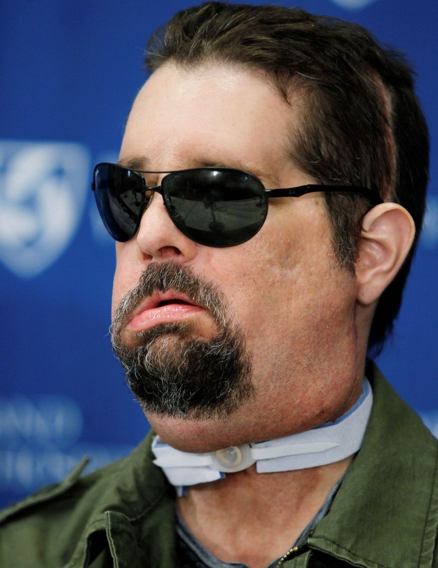 ASSOCIATED PRESS
Dallas Wiens says his new face "feels natural." The Fort Worth, Texas, man received a new nose, lips, skin, muscle and nerves after his face was severely burned in an accident.