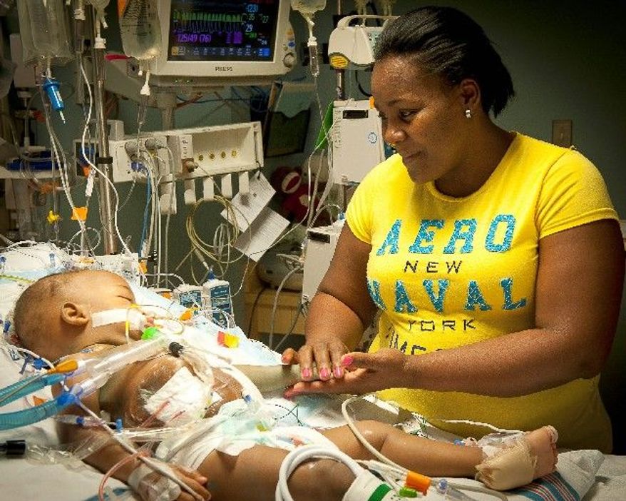 Lisandra Sanatis looks at her daughter, Maria, after surgery at Children's Hospital of Richmond at Virginia Commonwealth University. Maria was no longer joined with her sister. The twins were successfully separated. Maria and Teresa Tapia were born joined at the lower chest and abdomen, sharing a liver, pancreas and portion of the small intestine. (Associated Press)