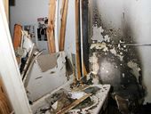 Meth Severe Burns_Live.jpg