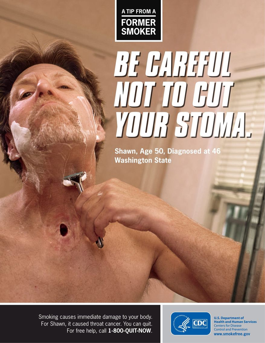 The federal government can require tobacco companies to "reserve significant packaging space" for anti-smoking warnings and graphic images, such as this one from the Centers for Disease Control and Prevention, a three-judge appellate panel ruled Monday. (Centers for Disease Control and Prevention via Associated Press)