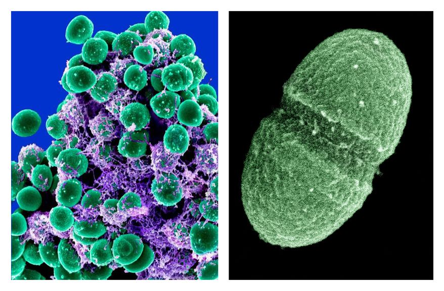 A clump of Staphylococcus epidermidis bacteria (left, in green) in the extracellular matrix, which connects cells and tissue, is shown under a scanning electron microscope. At right is the bacterium Enterococcus faecalis, which lives in the human gut. (Associated Press/National Institute of Allergy and Infectious Diseases and U.S. Department of Agriculture)