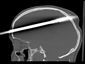 spear-gun-accident_lea_mugshot_four_by_three.jpg
