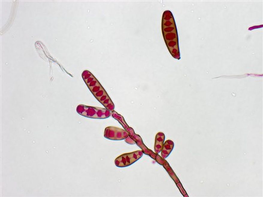 **FILE** The Exserohilum rostratum fungus is seen here. Exserohilum, a kind of black mold, is the primary cause of a number of fungal meningitis cases afflicting people who got steroid back injections for pain. (Associated Press/The Centers for Disease Control and Prevention)