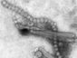 bird-flu-cdc_mugshot_four_by_three.jpg