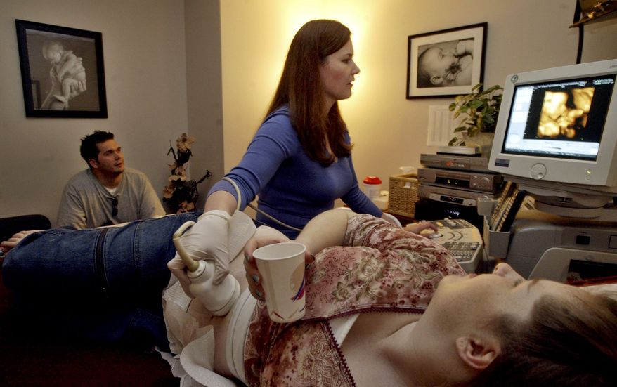 **FILE** A couple is shown a 4-D ultrasound image of their 24-week-old developing baby on a video monitor, March 16, 2004, at Fetal Fotos in Pasadena, Calif. (Associated Press)