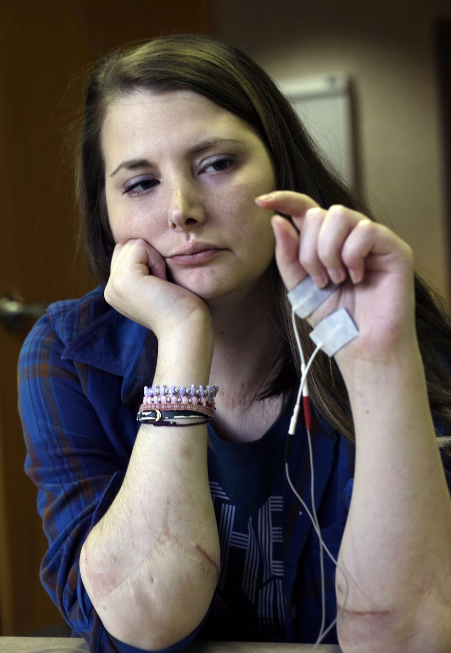 This photo taken Dec. 20, 2013 shows double hand transplant recipient Lindsay Aronson Ess working on her dexterity during a physical therapy session in Richmond, Va. Sure your liver or kidney could save someone's life. But would you donate your hands, or your face? Signing up to become an organ donor may get more complicated than just checking off a box on your driver's license. The government is preparing to regulate the new field of hand and face transplants like it does standard organ transplants, giving more Americans who are disabled or disfigured by injury, illness or combat a chance at qualifying for this radical kind of reconstruction. (AP Photo/Steve Helber)