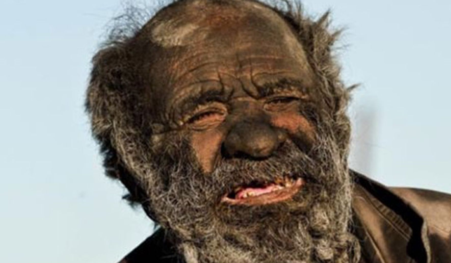 Самого грязного человека. Аму Хаджи человек который не мылся 60 лет. Самый грязный человек в мире Аму Хаджи.