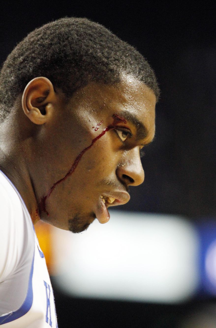 Kentucky's Dakari Johnson (44) leaves the game with a cut over his eye during the first half of an NCAA college basketball game against LSU, Saturday, Feb. 22, 2014, in Lexington, Ky. (AP Photo/James Crisp)