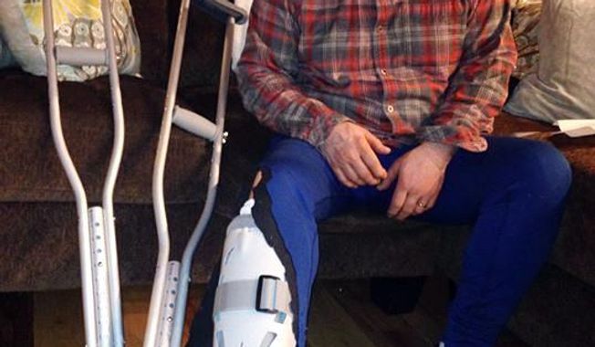 In this image provided by Chelsea Janssen, musher Scott Janssen poses for a photo showing his broken ankle on Wednesday, March 5, 2014 in Anchorage, Alaska. Janssen was flown to a hospital after a harrowing ordeal that included crashing his sled, hitting his head on a stump and later falling through ice and breaking his ankle during the Iditarod Trail Sled Dog Race.  Janssen, an Anchorage undertaker known as the Mushing Mortician, was back home early Wednesday after getting a cast for the broken bone he suffered on Tin Creek, about 40 miles from Nikolai, Alaska. (AP Photo/Chelsea Janssen)