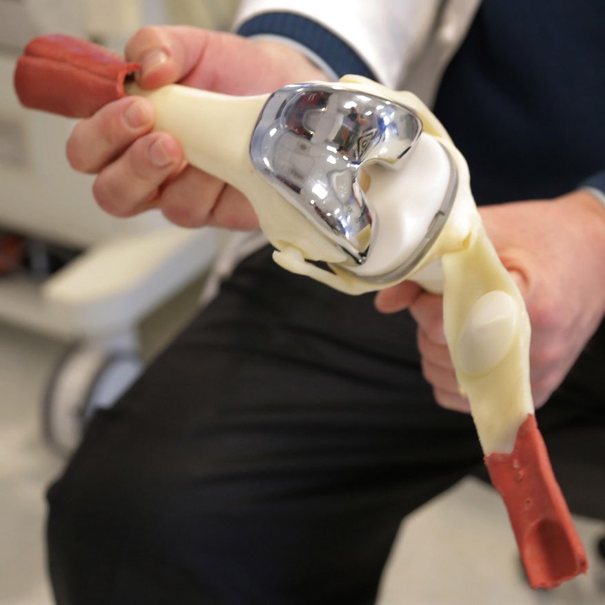 More than 600,000 knees and about 400,000 hips are replaced in the U.S. each year, and 3D imaging and printing software helps reduce surgery and recovery time and gives patients better-fitting, more comfortable replacements than traditional one-size-fits-all implants. (Associated Press/File)