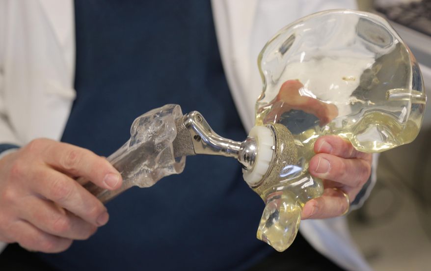 In this Wednesday, March 5, 2014 photo, Dr. Joshua Jacobs, orthopedics surgery chief at Rush University Medical Center and president of the American Academy of Orthopaedic Surgeons in Chicago, holds a model of a cementless hip replacement. About two of every 100 Americans now has an artificial joint, doctors are reporting. That's 2.5 million with a new hip and 4.7 million with a new knee, according to the first major study to look at how common these operations have become. Results were reported Tuesday, March 11, 2014 at an American Academy of Orthopaedic Surgeons conference in New Orleans. (AP Photo/M. Spencer Green)