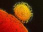 mers-virus-americanjpeg-05153_mugshot_four_by_three.jpg
