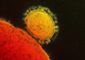 MERS Virus American.JPEG-05153.jpg