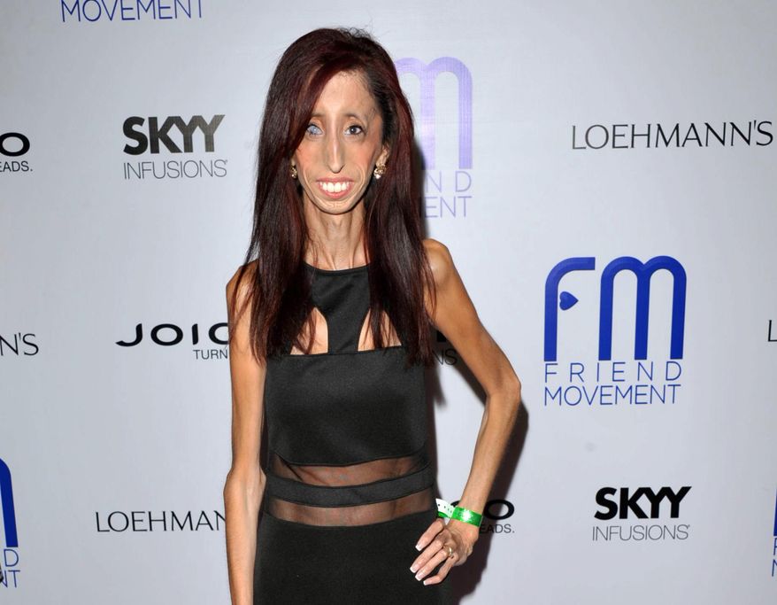 FILE - This July 1, 2013 file photo shows author and motivational speaker Lizzie Velasquez at the Friend Movement Anti-Bullying Benefit Concert at the El Rey Theatre in Los Angeles. Velasquez, who possesses a rare and unknown syndrome that prevents her from gaining weight, is raising funds on Kickstarter through June 1, 2014, for an anti-bulling documentary, titled, "The Lizzie Project." (Photo by John Shearer/Invision/AP, File)