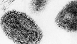 FILE - This 1975 file electronmicrograph from the Centers for Disease Control shows the smallpox virus. Government officials say workers cleaning a storage room at the National Institute of Health&#39;s campus in Maryland made a startling discovery last week _ decades-old vials of smallpox forgotten in a cardboard box. (AP Photo/CDC, File)