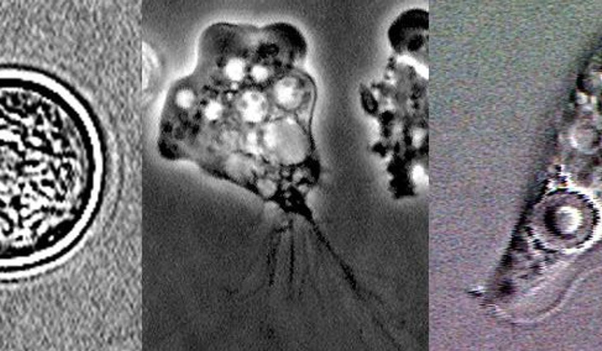 NextImg:Person dies after brain-eating amoeba infection in Florida, officials say
