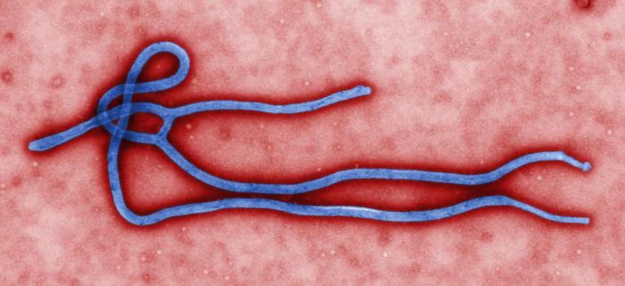 FILE - In this undated file image by the CDC shows an ebola Virus. U.S. health officials on Thursday, July 31, 2014, warned Americans not to travel to the three African countries, hit by an outbreak of Ebola. The travel advisory applies to non-essential travel to Guinea, Liberia and Sierra Leone. (AP Photo/CDC, File)