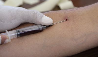 HIV infections acquired at health care jobs are now very rare in the United States, the federal government said Thursday. Of the dozens of known U.S. health care workplace-acquired HIV infections, most involved an accidental needle stick. (AP Photo/Luis Romero)