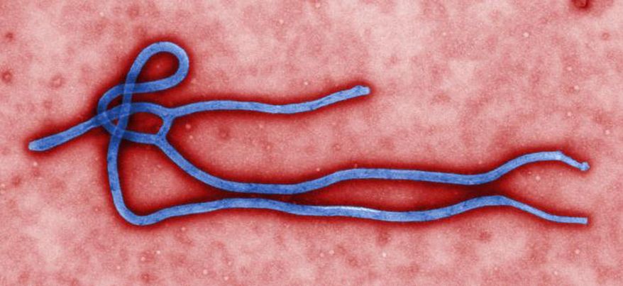 This undated file image made available by the Centers for Disease Control and Prevention shows the Ebola virus. (AP Photo/CDC, File)