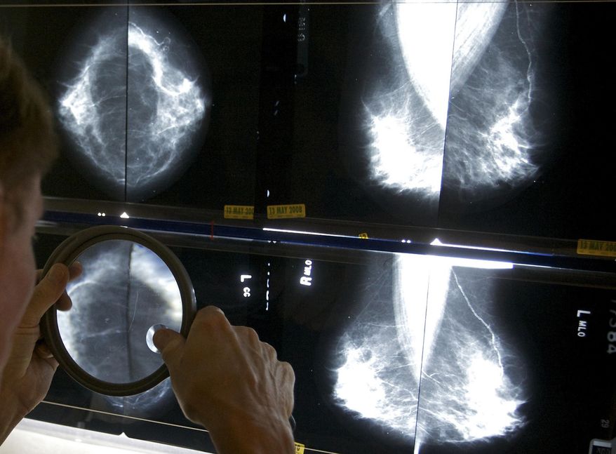FILE - In this May 6, 2010 file photo, a radiologist uses a magnifying glass to check mammograms for breast cancer in Los Angeles. Screening for cancer has gotten more complicated in recent years with evolving guidelines that sometimes conflict. Now a doctors' group aims to ease some confusion — and encourage more discussion of testing's pros and cons, with what it calls advice on "high-value screening" for five types of tumors. (AP Photo/Damian Dovarganes, File)