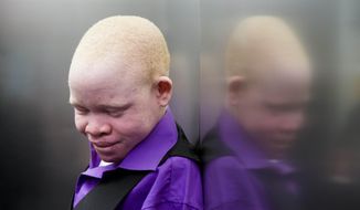 Emmanuel Rutema, 13, of Tanzania, rides an elevator before his surgery at the Shriners Hospital for Children in Philadelphia on Tuesday, June 30, 2015. Emmanuel Rutema and four other children also with the hereditary condition of albinism are in the U.S. to receive free surgery and prostheses at the hospital. The children were attacked and dismembered in the belief that their body parts will bring wealth. (AP Photo/Matt Rourke)