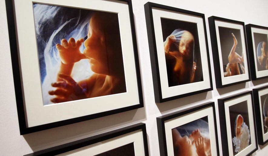 Photos of ' A Child is born ' work by Swedish photographer Lennart Nilsson are displayed during the media preview of an exhibit focusing on motherhood titled ' The Great Mother ' at Milan’s Palazzo Reale, Italy, Tuesday, Aug. 25, 2015. The exhibit, curated by the Nicola Trussardi Foundation’s artistic director Massimiliano Gioni, is opening Wednesday on the sidelines of Expo 2015 world’s fair and features over 400 works by 139 international artists, writers and directors. (Matteo Bazzi/ANSA via AP)
