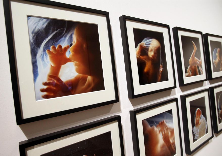 Photos of ' A Child is born ' work by Swedish photographer Lennart Nilsson are displayed during the media preview of an exhibit focusing on motherhood titled ' The Great Mother ' at Milan’s Palazzo Reale, Italy, Tuesday, Aug. 25, 2015. The exhibit, curated by the Nicola Trussardi Foundation’s artistic director Massimiliano Gioni, is opening Wednesday on the sidelines of Expo 2015 world’s fair and features over 400 works by 139 international artists, writers and directors. (Matteo Bazzi/ANSA via AP)