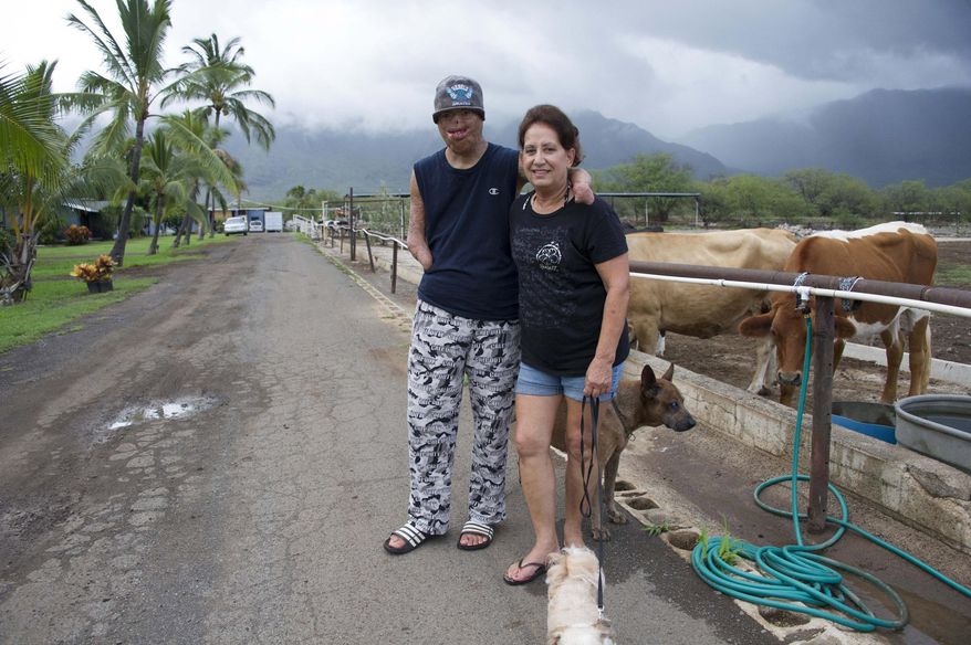 ADVANCE FOR SATURDAY SEPT. 5, 2015 AND THEREAFTER - In this Aug. 24, 2015 photo, Cody Costa walks on the family farm with his grandmother, Donna Costa, at his home in Waianae, Hawaii. Costa bears most obviously the marks of a horrific childhood accident that left him with third-degree burns over 75 percent of his body. Against every reasonable prognosis, Costa survived and has spent most of the last two decades defying expectations of what his life could and should be. Now at age 23, he is trying to carve a niche for himself in the adult working world. (Craig T. Kojima/The Honolulu Star-Advertiser via AP)
