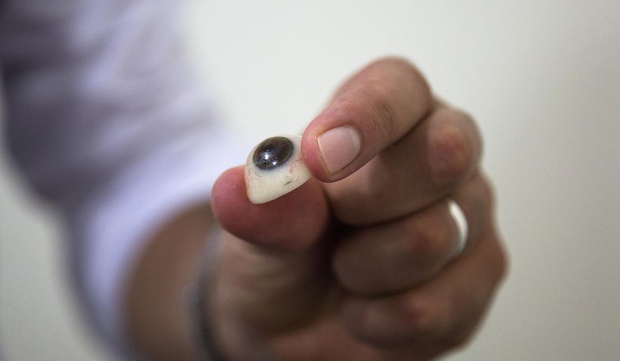 In this Tuesday, Oct. 6, 2015, file photo, Yousef Hussein, an oculist, displays an artificial eye at Al-Radwan Clinic in Gaza City. Established in 2013, the center assists those who lost an eye to an illness, congenital defects or injury, including those in conflicts. Al-Radwan is the only company in Gaza to design and fit artificial eyes. (AP Photo/Adel Hana)