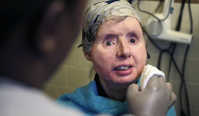 FILE - In this Feb. 20, 2015 file photo, Charla Nash smiles as her care worker washes her face at her apartment in Boston. The Connecticut woman who underwent a face transplant five years ago after being attacked by a chimpanzee is back in a Boston hospital after doctors discovered her body is rejecting the transplant. Nash says doctors have decided to end an experimental drug treatment and put her back on her original medication in the hopes of reversing the rejection.  (AP Photo/Charles Krupa, File)