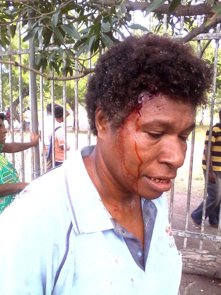 In this photo provided by Staycey Yalo, 34-year-old Esther Was bleeds from a head wound suffered during a student protest Wednesday, June 8, 2016, in Port Moresby, Papua New Guinea. Police fired gunshots to quell the protest demanding the resignation of Prime Minister Peter O'Neill, the government said. (Staycey Yalo via AP) EDITORIAL USE ONLY