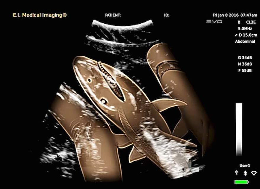 Discovery featured a rare "shark sonogram" during its 2016 "Shark Week" programming. (YouTube, Discovery)