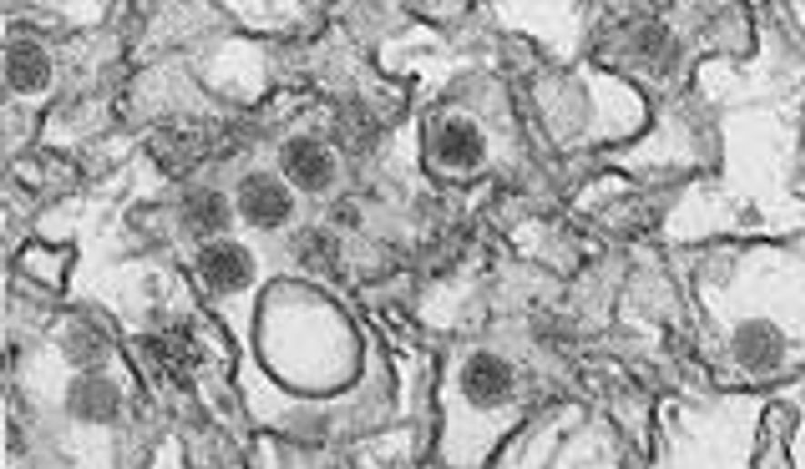 FILE - This January 2016 microscope image provided by the Centers for Disease Control and Prevention shows the Zika virus. On Friday, July 15, 2016, the CDC said a New York City woman infected her male partner with Zika virus through sex, the first time female-to-male transmission of the germ has been documented. (Cynthia Goldsmith/CDC via AP)