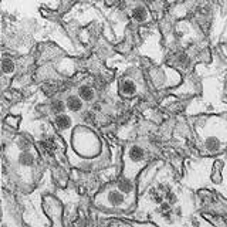 FILE - This January 2016 microscope image provided by the Centers for Disease Control and Prevention shows the Zika virus. On Friday, July 15, 2016, the CDC said a New York City woman infected her male partner with Zika virus through sex, the first time female-to-male transmission of the germ has been documented. (Cynthia Goldsmith/CDC via AP)